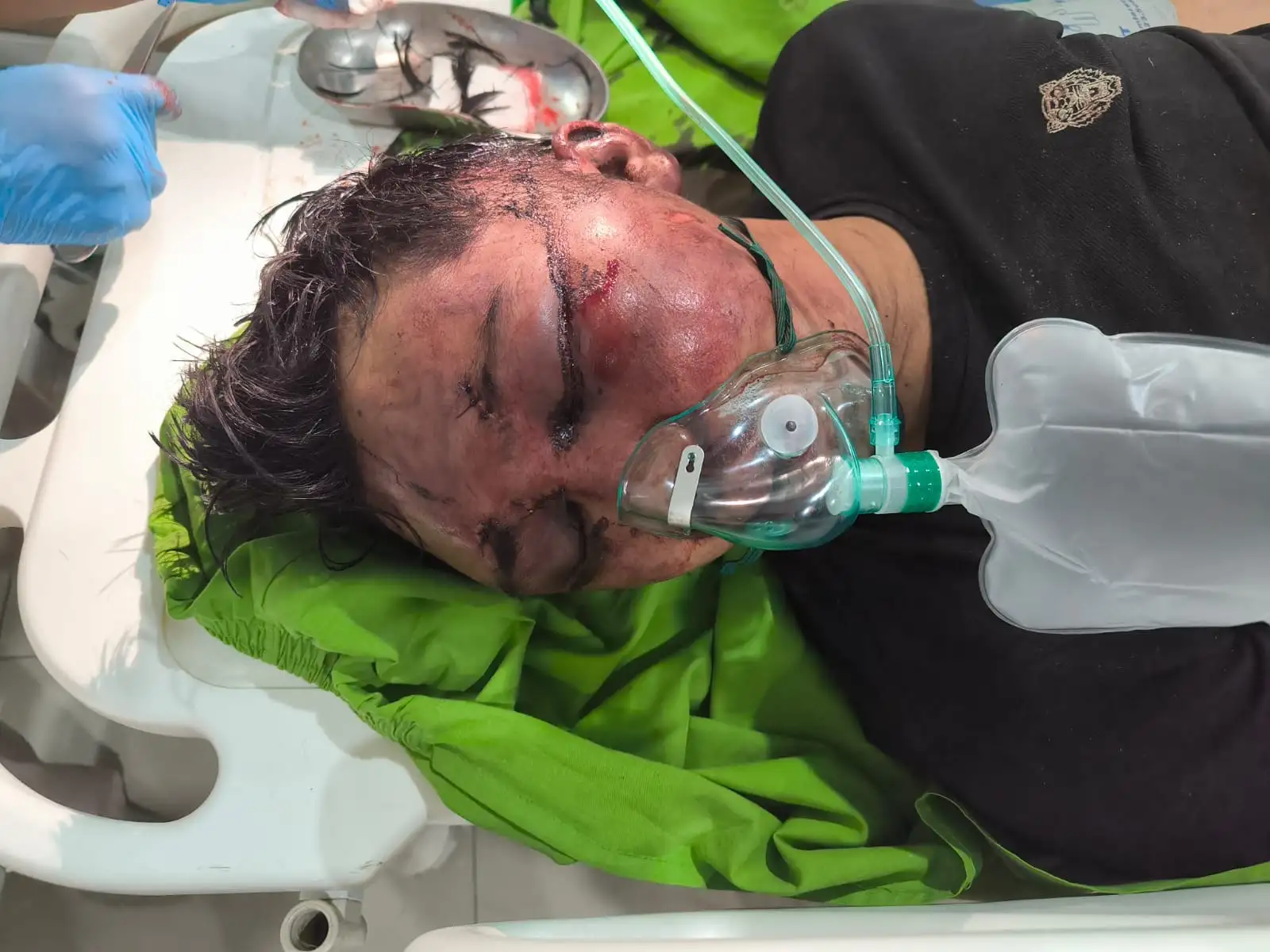 Diduga Curi Sepeda Motor, Pria Nyaris Tewas Diamuk Massa di STM Hilir